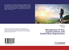 Buchcover von Management of Peri-implant Defects with Guided Bone Regeneration