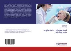 Buchcover von Implants in children and adolescents