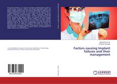 Buchcover von Factors causing Implant failures and their management