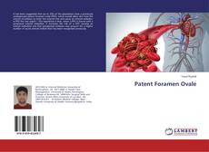 Buchcover von Patent Foramen Ovale