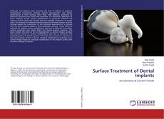 Bookcover of Surface Treatment of Dental Implants