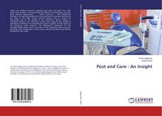 Bookcover of Post and Core : An Insight