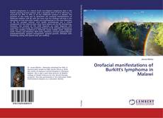 Couverture de Orofacial manifestations of Burkitt's lymphoma in Malawi