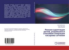 Copertina di Ранняя адаптация детей, родившихся способом операции кесарева сечения