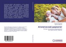 Buchcover von Атопический дерматит