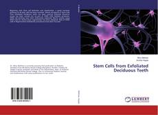 Copertina di Stem Cells from Exfoliated Deciduous Teeth