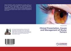 Buchcover von Clinical Presentation, Causes and Management of Ocular Tumors