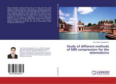 Borítókép a  Study of different methods of MRI compression for the telemedicine - hoz