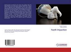 Tooth Impaction的封面