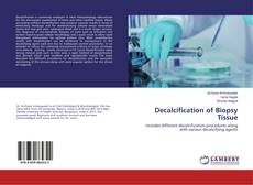 Borítókép a  Decalcification of Biopsy Tissue - hoz
