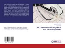 Borítókép a  An Overview on Arrhythmia and its management - hoz