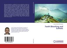 Bookcover of Tooth Bleaching and Esthetic