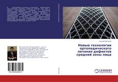 Copertina di Новые технологии ортопедического лечения дефектов средней зоны лица