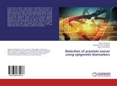 Buchcover von Detection of prostate cancer using epigenetic biomarkers