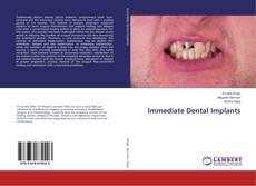 Copertina di Immediate Dental Implants