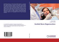 Buchcover von Guided Bone Regeneration