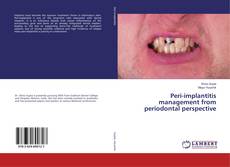 Buchcover von Peri-implantitis management from periodontal perspective