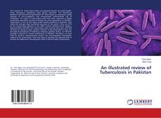 Buchcover von An illustrated review of Tuberculosis in Pakistan