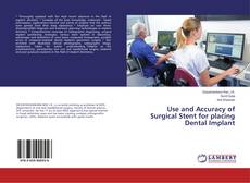 Copertina di Use and Accuracy of Surgical Stent for placing Dental Implant