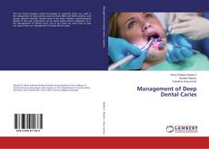 Bookcover of Management of Deep Dental Caries