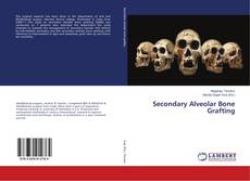 Buchcover von Secondary Alveolar Bone Grafting