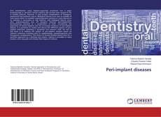 Copertina di Peri-implant diseases