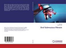 Buchcover von Oral Submucous Fibrosis