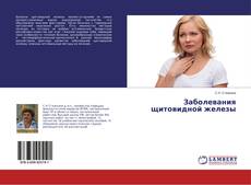 Bookcover of Заболевания щитовидной железы