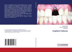 Portada del libro de Implant Failures