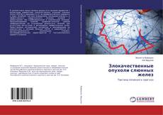 Copertina di Злокачественные опухоли слюнных желез