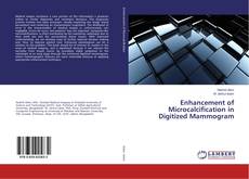 Buchcover von Enhancement of Microcalcification in Digitized Mammogram