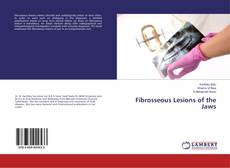 Copertina di Fibrosseous Lesions of the Jaws