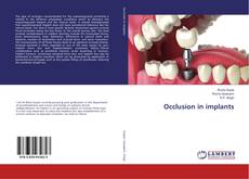 Borítókép a  Occlusion in implants - hoz