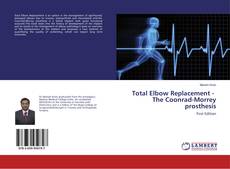 Buchcover von Total Elbow Replacement - The Coonrad-Morrey prosthesis
