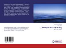Copertina di Osteoporosis-our reality