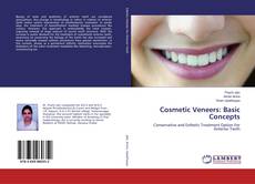 Bookcover of Cosmetic Veneers: Basic Concepts
