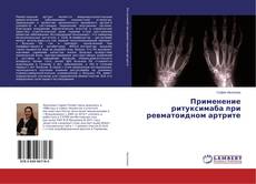 Buchcover von Применение ритуксимаба при ревматоидном артрите