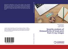 Borítókép a  Severity analysis of Osteoarthritis of knee joint from X-ray images - hoz