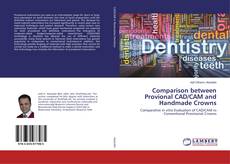 Buchcover von Comparison between Provional CAD/CAM and Handmade Crowns