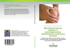 Bookcover of Внутрисуставные травмы и ортопедические заболевания коленного сустава
