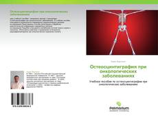 Buchcover von Остеосцинтиграфия при онкологических заболеваниях