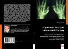 Couverture de Augmented Reality in Laparoscopic Surgery