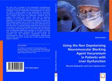 Using the Non Depolarizing Neuromuscular Blocking Agent Vecuronium in Patients with Liver Dysfunction的封面