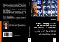 Buchcover von Cardiac Imaging Studies of Infarcted Heart with and without Cell Injections