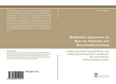 Portada del libro de Molekulare Signaturen im Blut von Patienten mit Bronchialkarzinomen