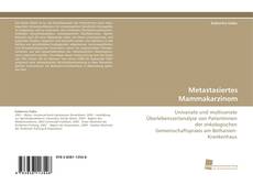 Buchcover von Metastasiertes Mammakarzinom