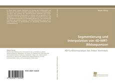 Copertina di Segmentierung und Interpolation von 4D-MRT-Bildsequenzen