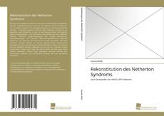 Portada del libro de Rekonstitution des Netherton Syndroms