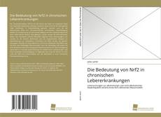 Copertina di Die Bedeutung von Nrf2 in chronischen Lebererkrankungen