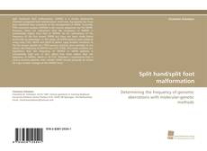 Portada del libro de Split hand/split foot malformation